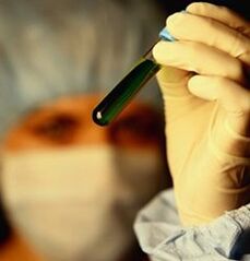 kumaha carana meunang dites pikeun parasit